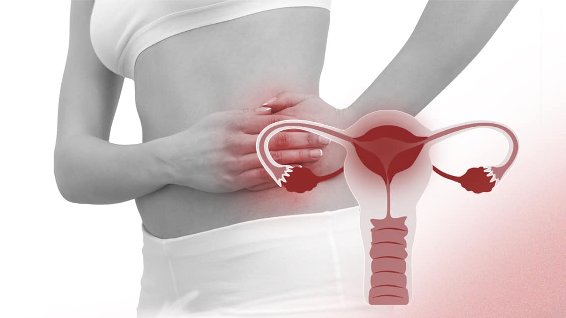 Pelvic Inflammatory Disease (PID) - Causes, Symptoms, Treatment & Diagnosis